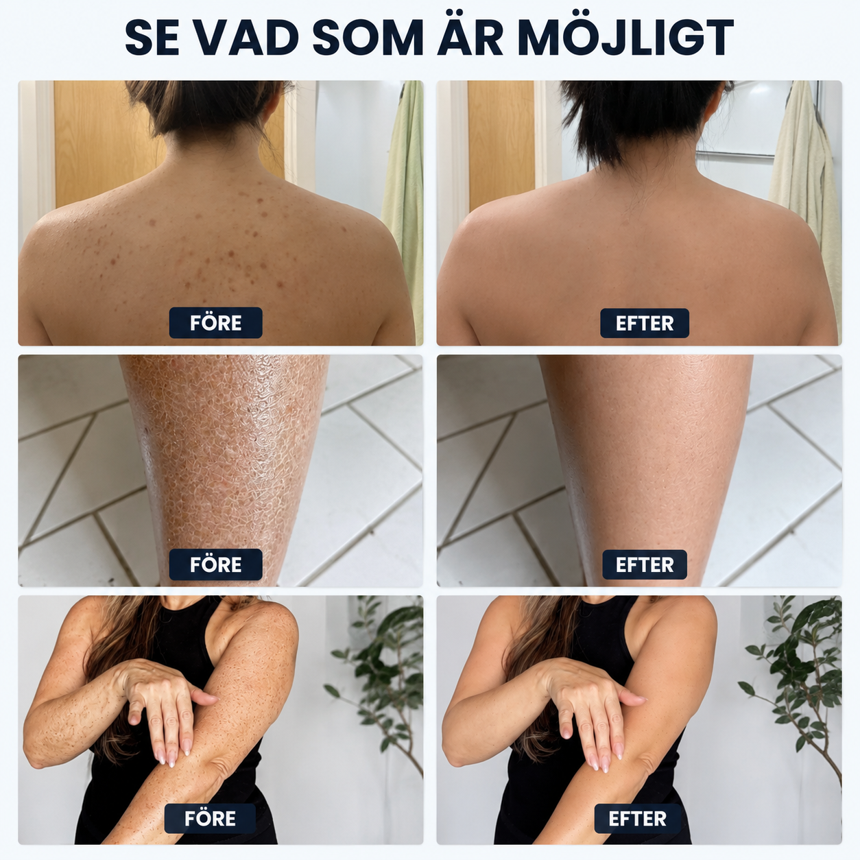 BodyScrub™ - Exfolierande Antibakteriell Duschhandduk