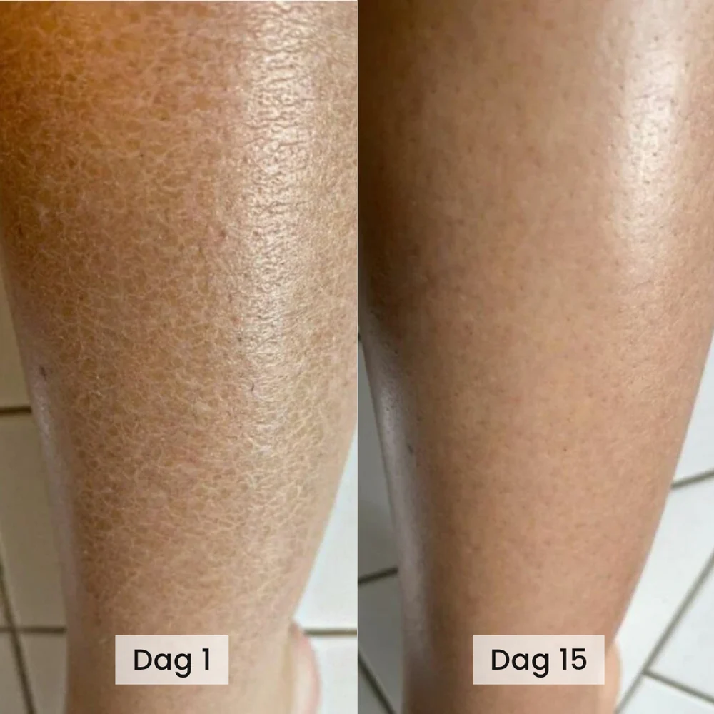 BodyScrub™ - Känns huden fortfarande torr och sträv efter duschen?