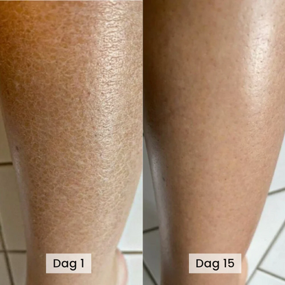 BodyScrub™ - Känns huden fortfarande torr och sträv efter duschen?